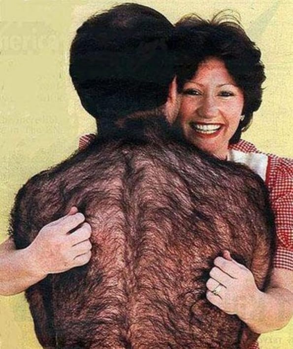 Caption This: Hairy Back [Closed]