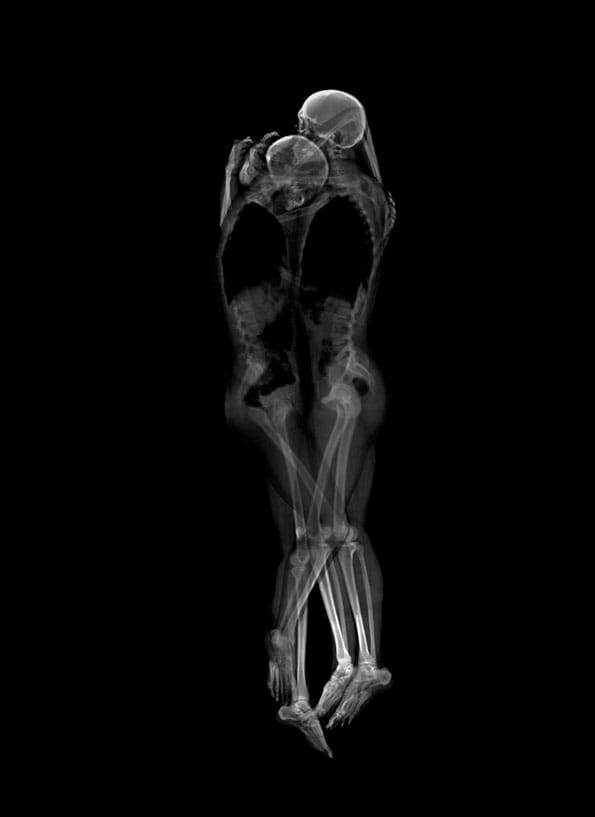 X-Rays Of Couples Sleeping