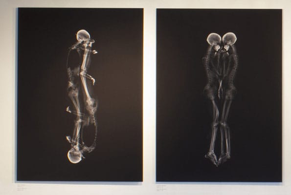 couples-sleep-x-ray-3