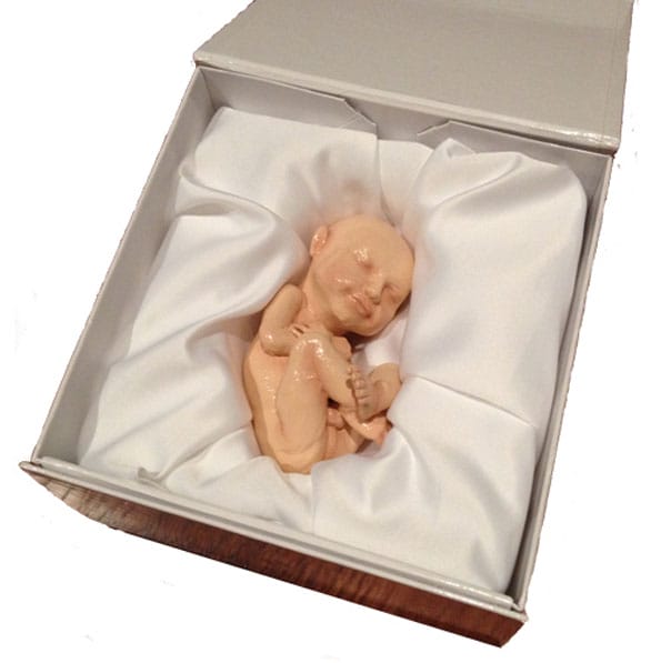 3D Printed Model Of Your Fetus