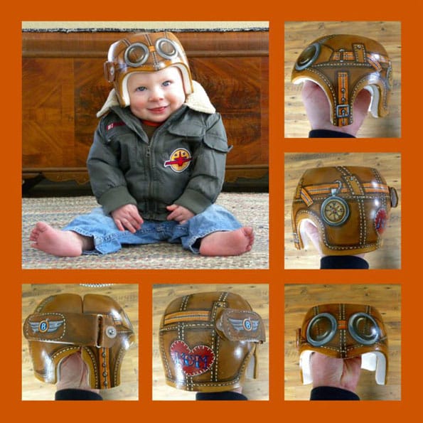 baby-medical-helmet-designs-3