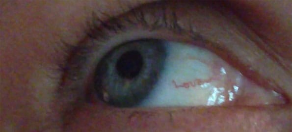 love-eyeball-blood-vessel