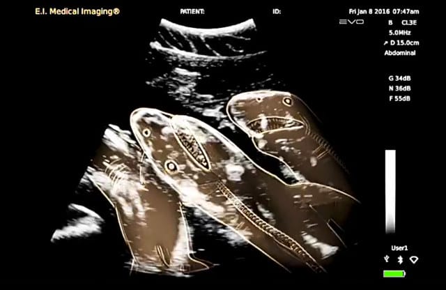 See Researchers Give A Pregnant Shark A Sonogram!