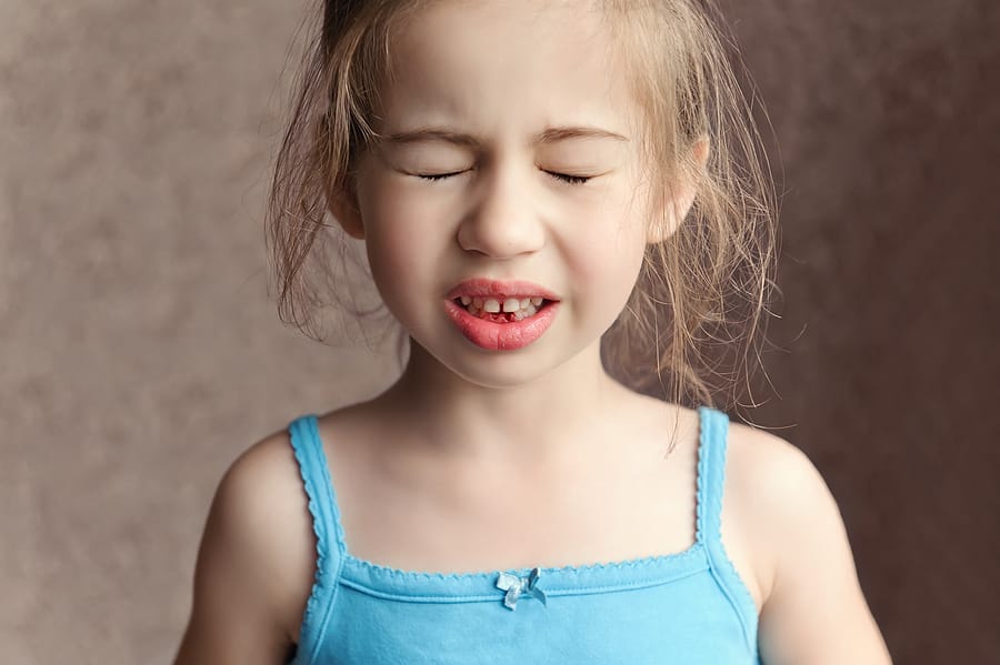How To Tell If Your Kids Have Sensitive Gums