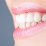 Boost Self Confidence With Proper Dental Health