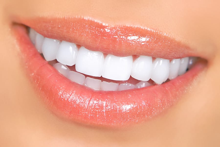 Life Changing Benefits of Teeth Whitening