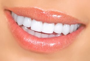 Life Changing Benefits of Teeth Whitening