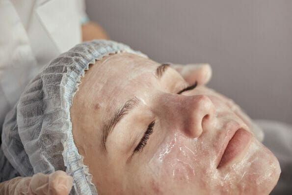 Acne treatment in a beauty salon. Close-up of a womans face with acne post-acne